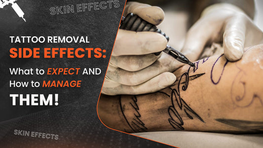 Tattoo Removal Side Effects: What to Expect and How to Manage Them!